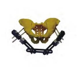 Orthopedic Surgical External Fixator/External Fixation