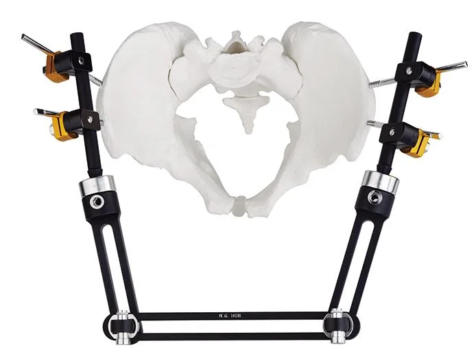 High Quality Orthofix Pelvic External Fixator for Pelvic Fixation Surgery Orthopedic External Fixator Instrument