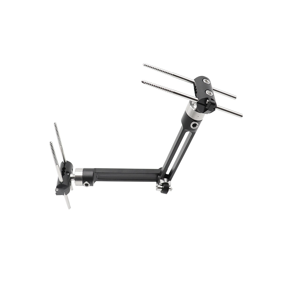 Pelvic fixation surgery pelvic external fixator hot selling pelvic external fixator