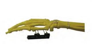 Orthopedic Surgical External Fixator/External Fixation