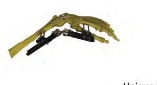 Orthopedic surgery external fixator / external fixator