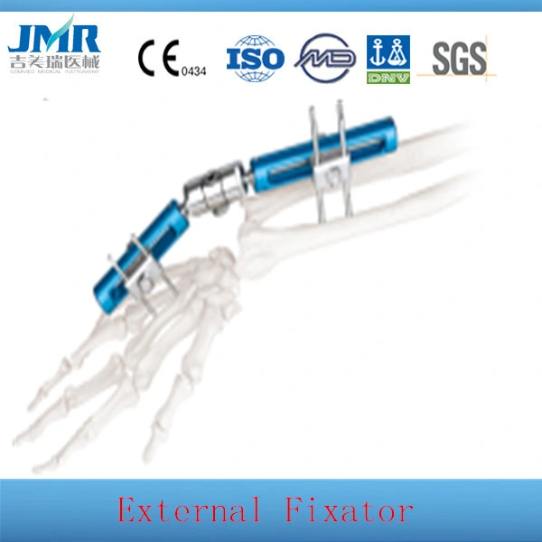 Sterlized Wrist Fixation , Wrist External Fixator, Wrist External Fixation
