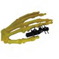 Orthopedic surgery external fixator / external fixator